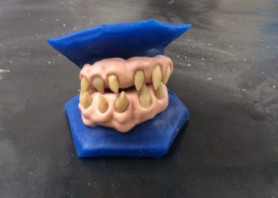 Denali's Prosthetic Teeth for Blood Drive S1