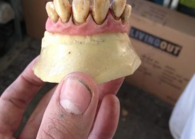 Prosthetic Caveman Teeth